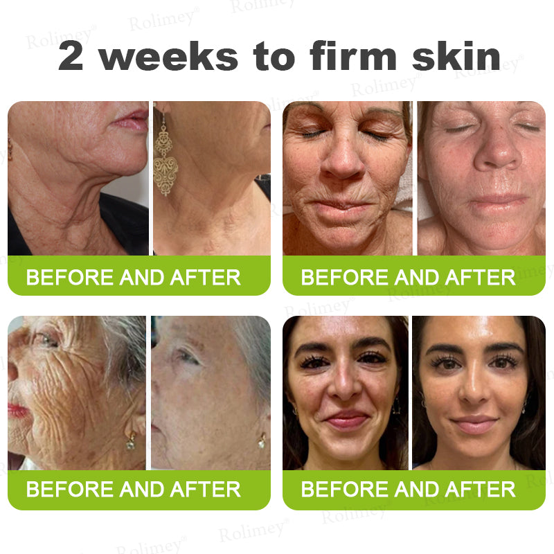 Botox & Vita A Retinol Shot Wrinkle - Lift Tightening cream