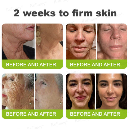 Botox & Vita A Retinol Shot Wrinkle - Lift Tightening cream