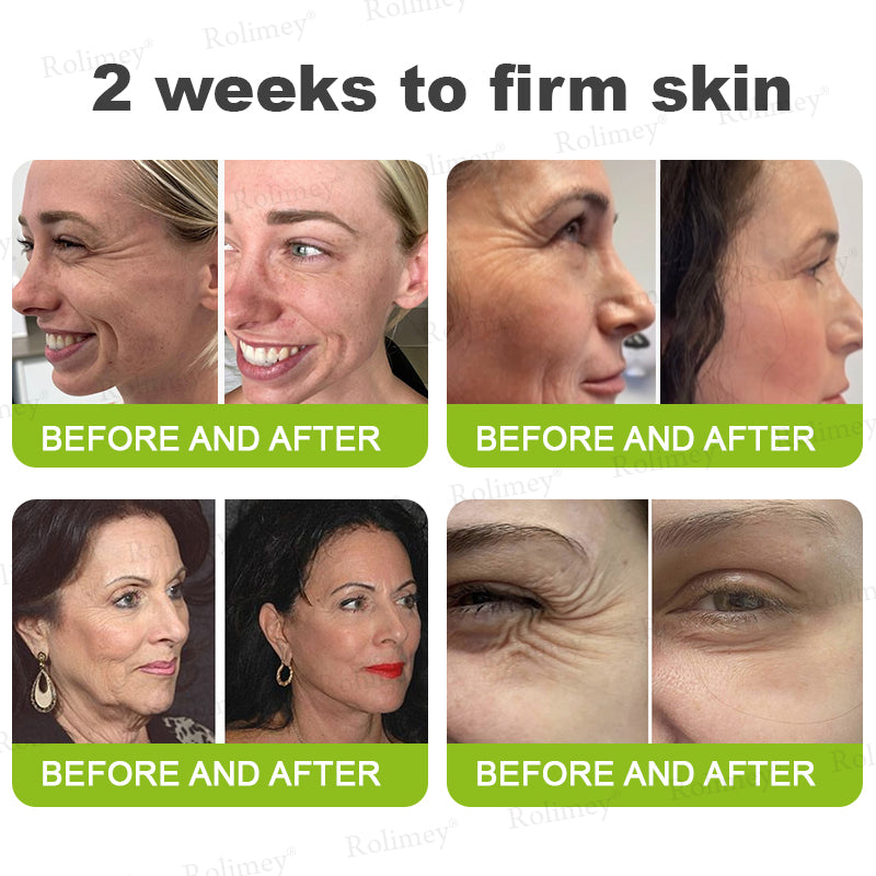 Botox & Vita A Retinol Shot Wrinkle - Lift Tightening cream