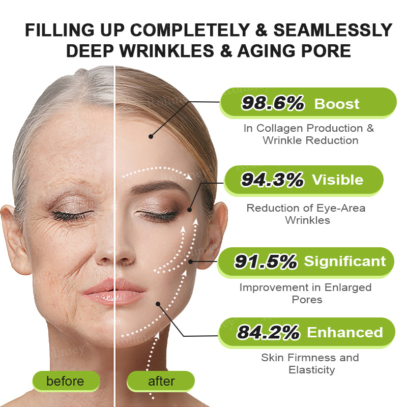 Botox & Vita A Retinol Shot Wrinkle - Lift Tightening cream