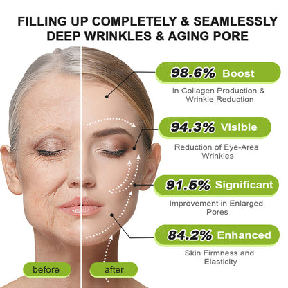 Botox & Vita A Retinol Shot Wrinkle - Lift Tightening cream