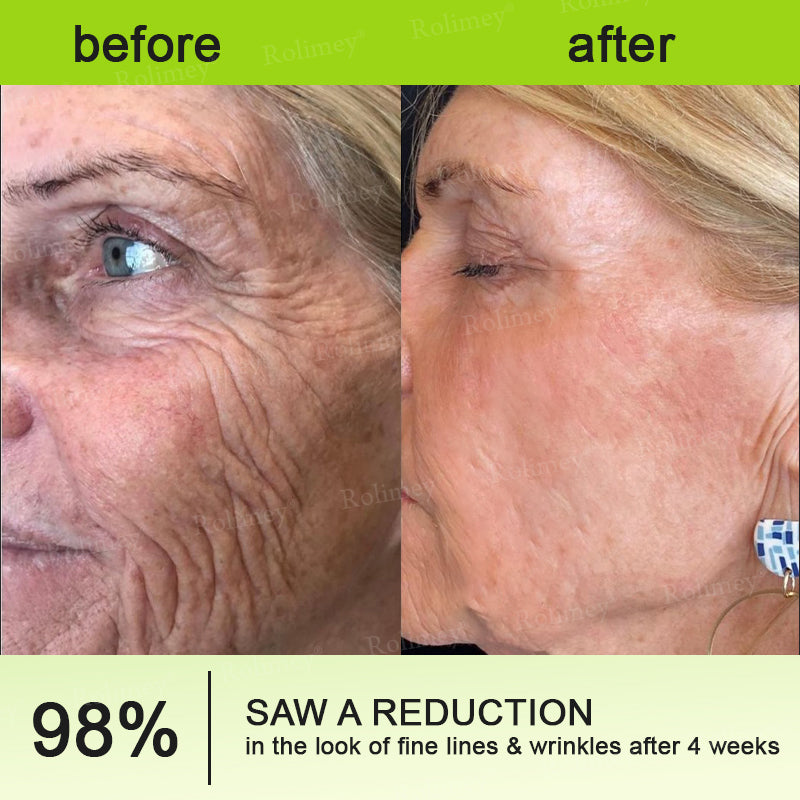 Botox & Vita A Retinol Shot Wrinkle - Lift Tightening cream