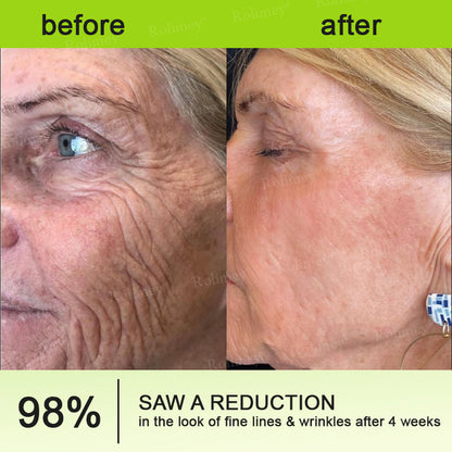 Botox & Vita A Retinol Shot Wrinkle - Lift Tightening cream