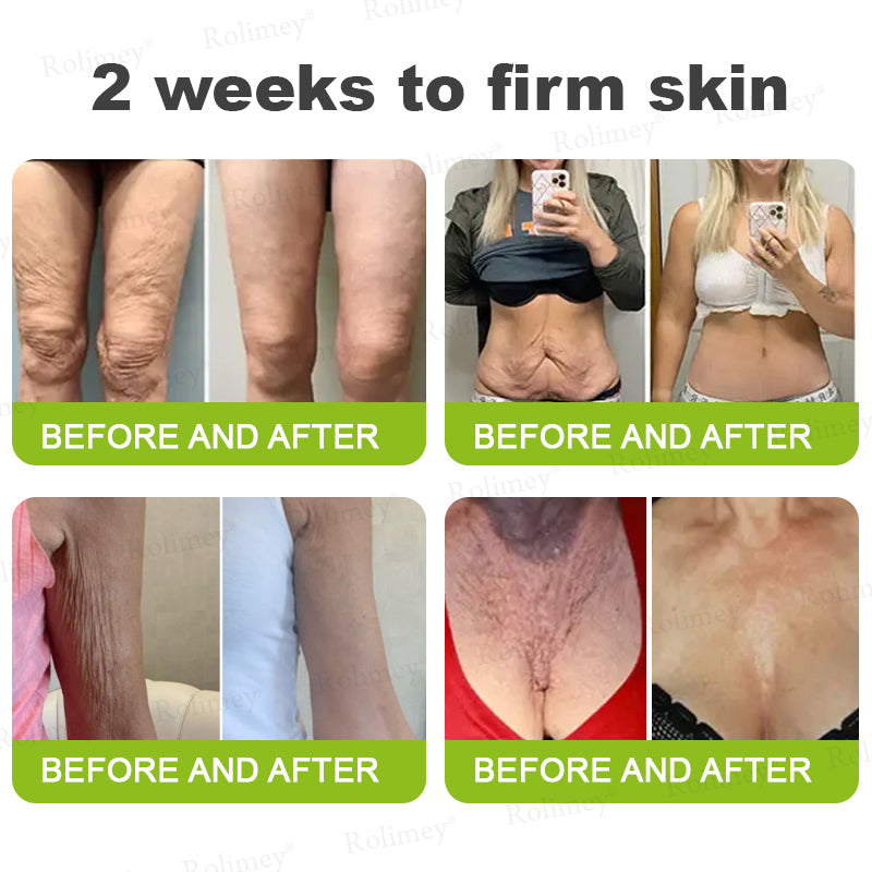 Botox & Vita A Retinol Shot Wrinkle - Lift Tightening cream