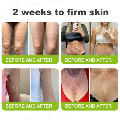 Botox & Vita A Retinol Shot Wrinkle - Lift Tightening cream