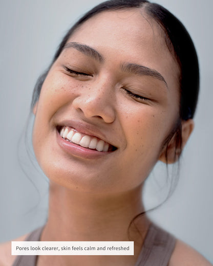 🧄💞LAST DAY 50% OFF ✨Deep-Clean Nose Strips – Removes Blackheads & Tightens Pores