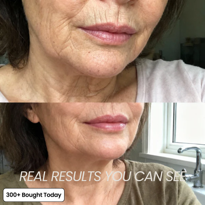 💞LAST DAY 50% OFF ✨Collagen Plump & Repair Balm
