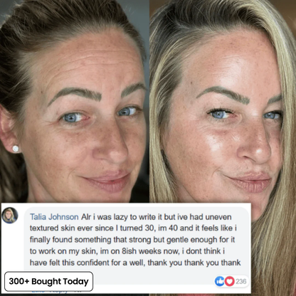💞LAST DAY 50% OFF ✨Collagen Plump & Repair Balm